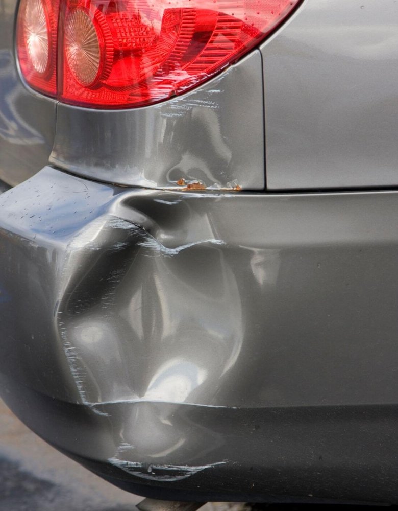 Dent Repair Edmonton Auto Body Shop